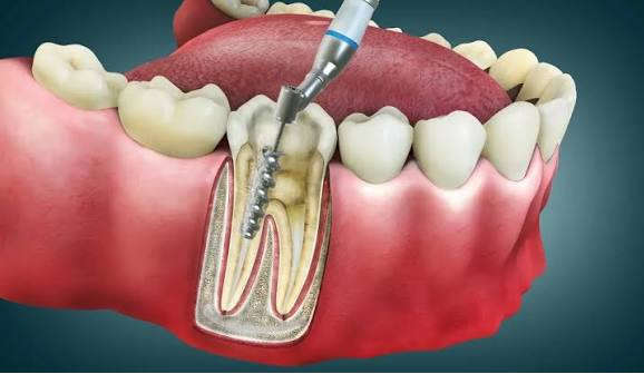 Panoramik röntgen cihazı ve görüntüsü